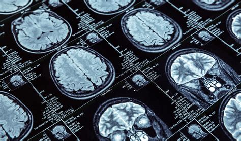 Diagrama de las diferentes resonancias en Absolute Resonance