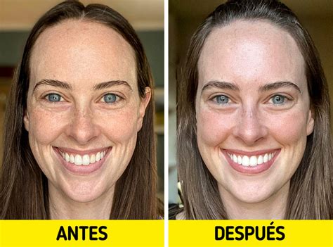 Antes y después del uso de crema Nadinola