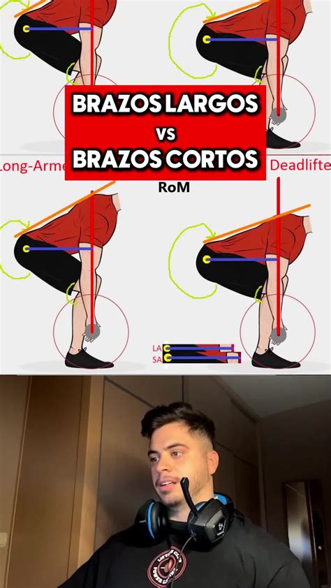 Comparativa de brazos saludables vs. brazos con Synthol
