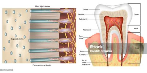 Esquema de un diente con cámara pulpar y túbulos dentinarios