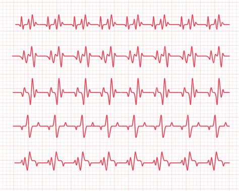 Gráfico de ritmo cardíaco en Rent-a-Girlfriend