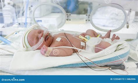 Bebé prematuro en incubadora
