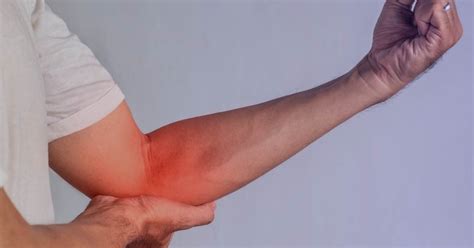 Trunks con el brazo izquierdo herido