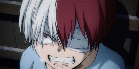 La cicatriz de Shoto Todoroki