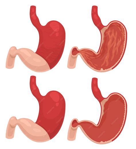 Infografía mostrando diferentes personajes con estómagos rugiendo