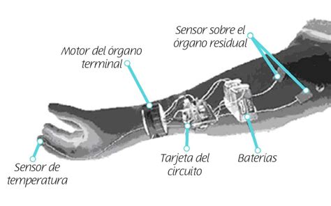 Diagrama comparativo de prótesis de brazos en Naruto