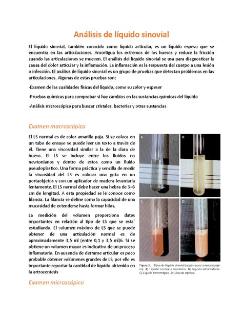 Análisis de líquido en frasco por parte de Erwin y Levi