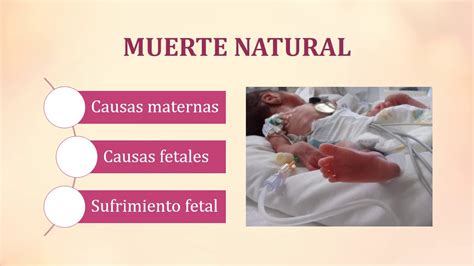 Infografía sobre las causas comunes de muerte fetal.