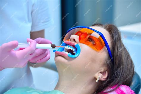 Imagen de un dentista aplicando gel blanqueador en un consultorio