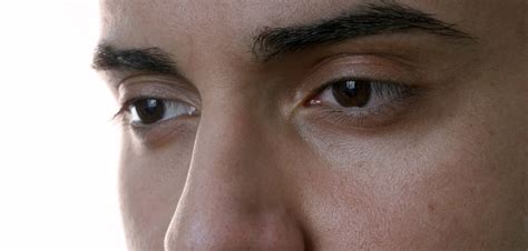 Sabo con la cicatriz en el ojo