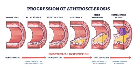 Infografía de la progresión de Haikyuu!!