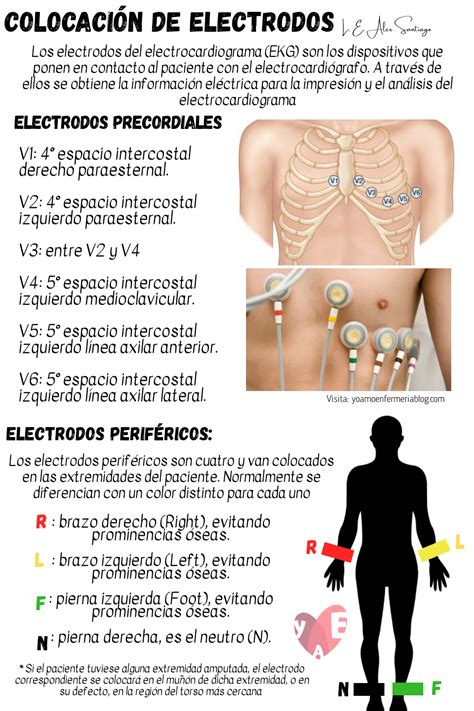 Diagrama de colocación de electrodos EMG en la musculatura del tronco