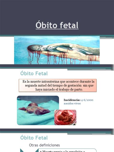 Diagrama de causas del óbito fetal