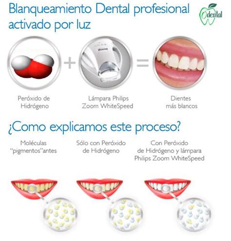 Diagrama del funcionamiento de un kit de blanqueamiento dental LED