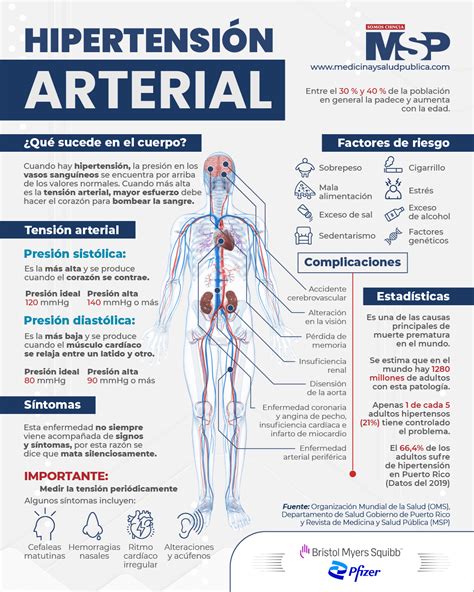 Infografía sobre los efectos de la hipertensión arterial en el cerebro.