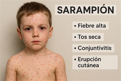 Ilustración de Arturo Moreno con Chito y Sarampión