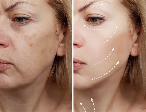 Ejemplo de contorno facial detallado de Kakashi