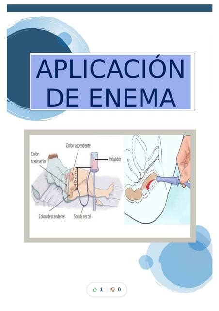 Diagrama paso a paso para la administración de un enema casero
