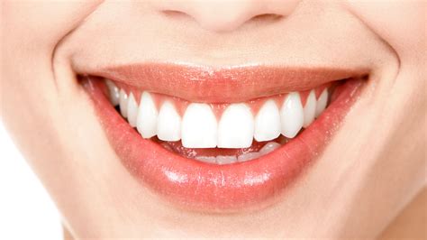 Fotomontaje de una sonrisa brillante y dientes blancos