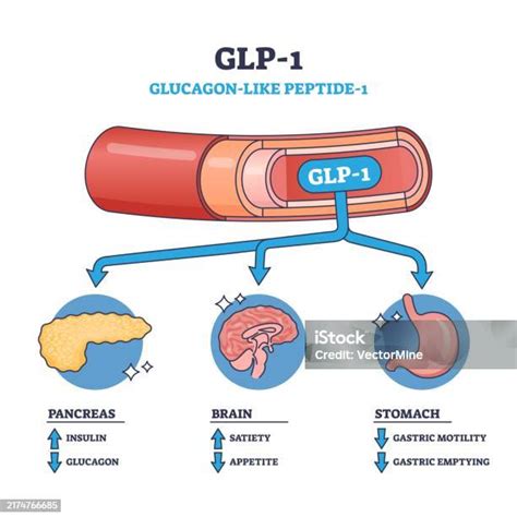 Diagrama que muestra los efectos de la poción en los miembros del gremio