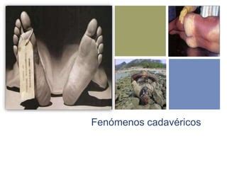 Ilustración de los fenómenos cadavéricos