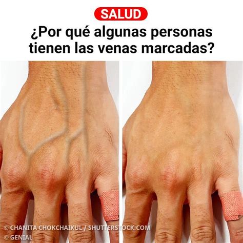 Representación artística del Byakugan con sus venas marcadas