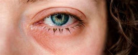 Detalle de las ojeras rojas y guantes de Oosaki