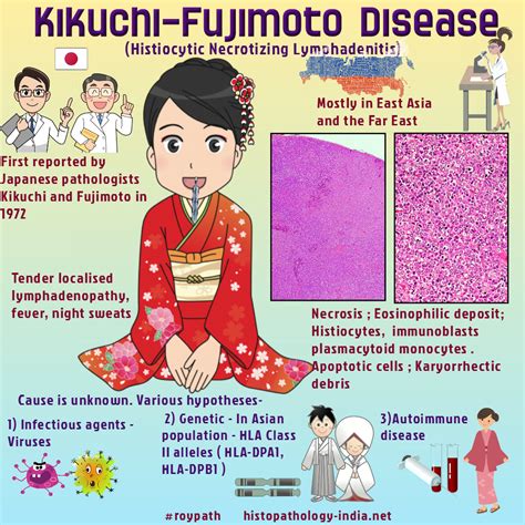 Mapa mundial mostrando la distribución de casos de Enfermedad de Kikuchi-Fujimoto