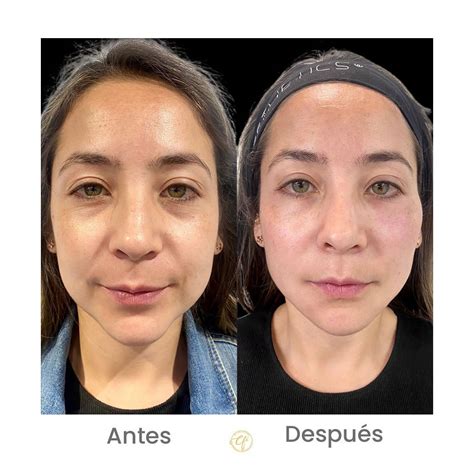Comparativa del rostro de Kakashi antes y después de la guerra