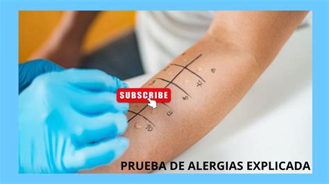 Diagrama de prueba de alergia cutánea
