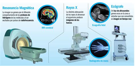Comparativa de diferentes técnicas de diagnóstico por imagen: Rayos X, TC, RM, Ecografía