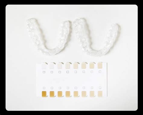 Bandejas de blanqueamiento dental personalizadas