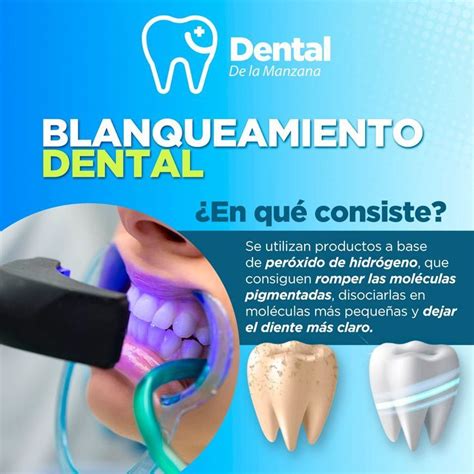 Ejemplo de campaña publicitaria de blanqueamiento dental dirigida a hombres