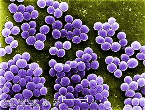 Representación microscópica de la bacteria Staphylococcus aureus
