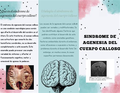 Infografía sobre las causas y síntomas de la agenesia del cuerpo calloso