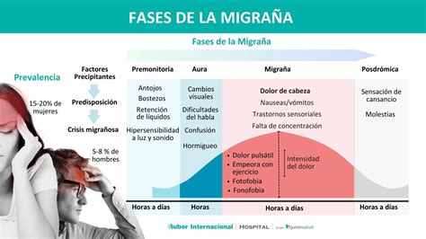 Ilustración de los síntomas del aura de la migraña