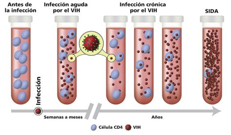 Ilustración de las tres etapas de la infección del árbol podrido