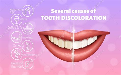 Infografía mostrando las causas comunes de la decoloración dental.