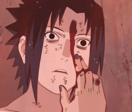 Itachi coloca el sello en Sasuke