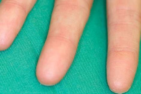 Primer plano de manos sin huellas dactilares