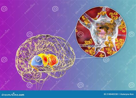 Ilustración conceptual de un parásito atacando el cerebro