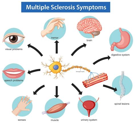 Diagrama que ilustra los síntomas de la misofobia