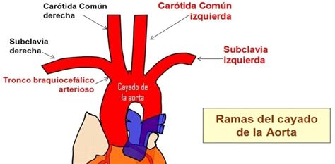 Anatomía del tronco braquiocefálico y venas adyacentes